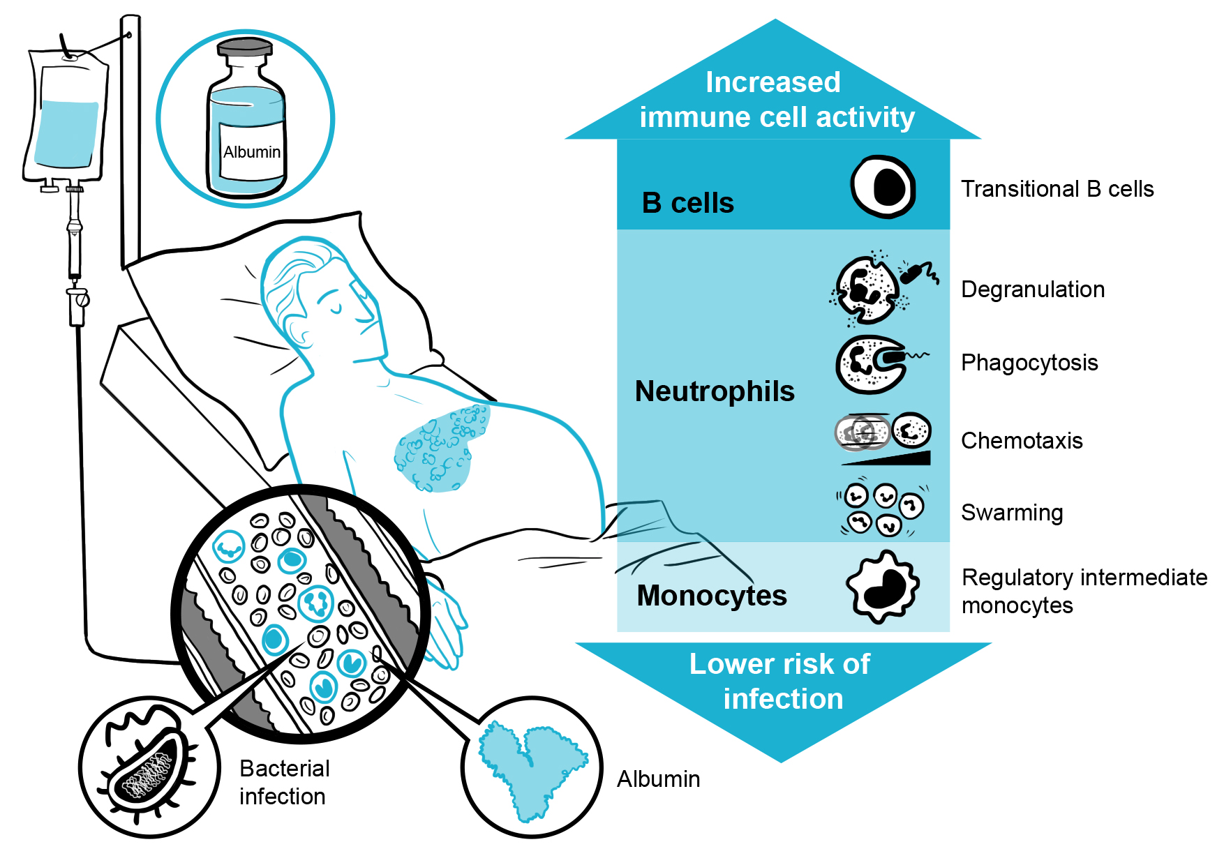 Albumin boosts immune system function in patients with decompensated cirrhosis